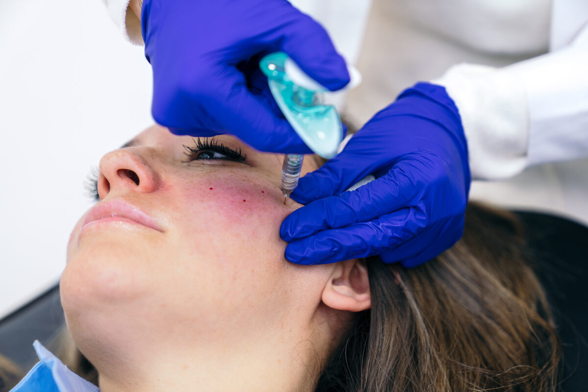 Assessing Your Needs for Botox